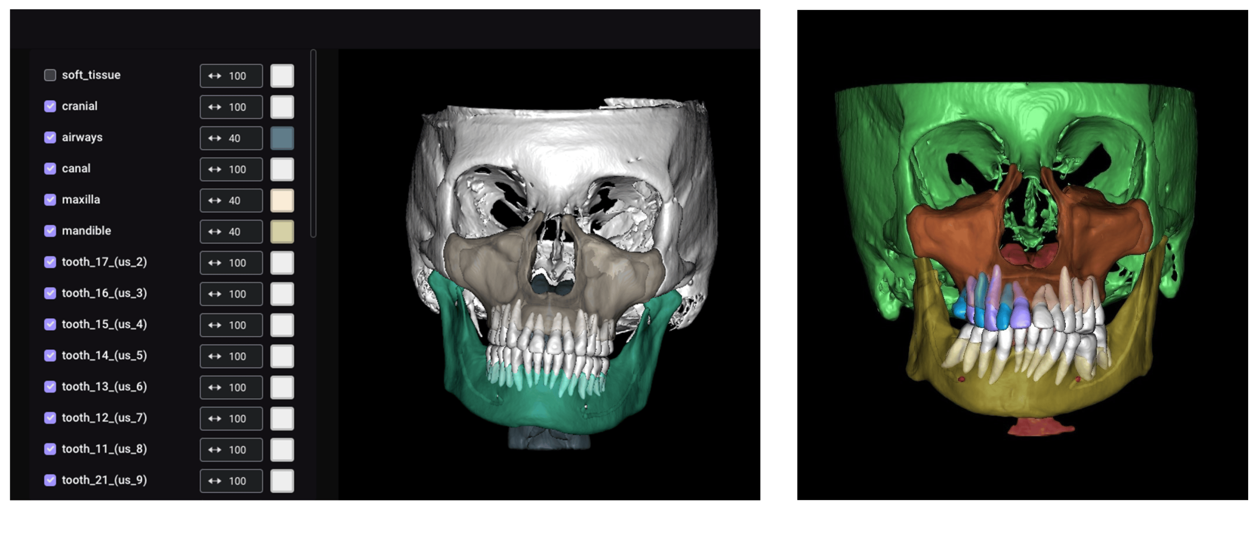 تجهیزات دیجیتال دندانپزشکی ۲۰۲۵ cbct ai