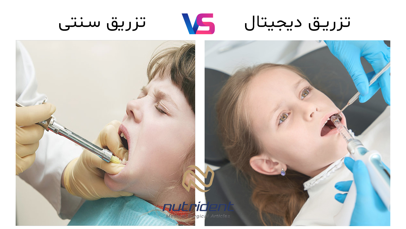 تزریق دیجیتال و سنتی در دندانپزشکی