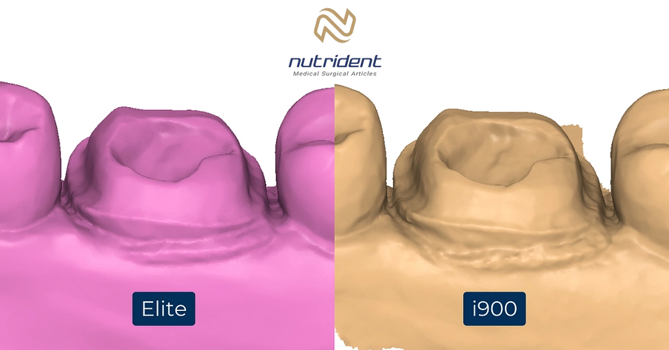 مقایسه اسکنر شاینینگ 3D با Medit i900 در نوتریدنت