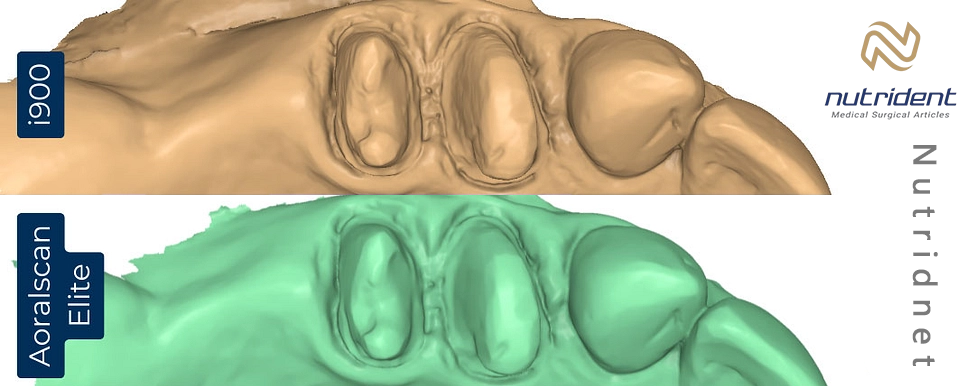 مقایسه کیفیت اسکن  اسکنر شاینینگ 3D با Medit i900 