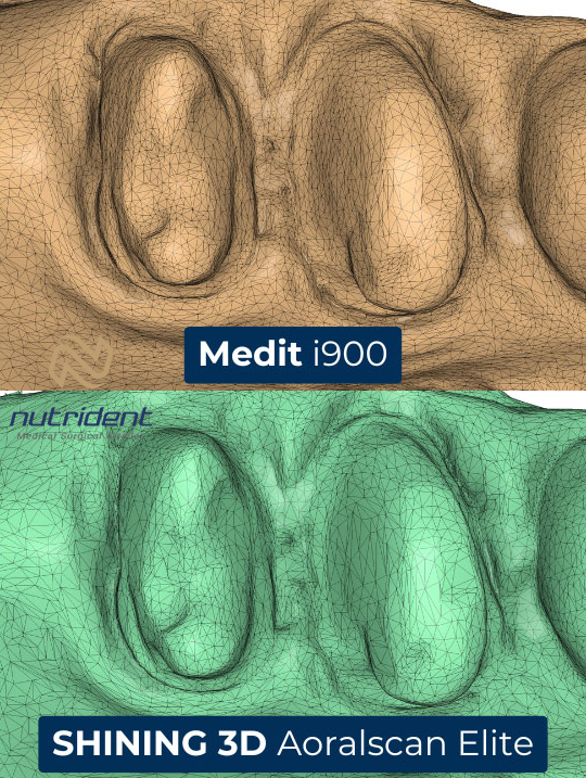 کیفیت رنگ (تکسچر) اسکنر مدیت i900 و شاینینگ 3d