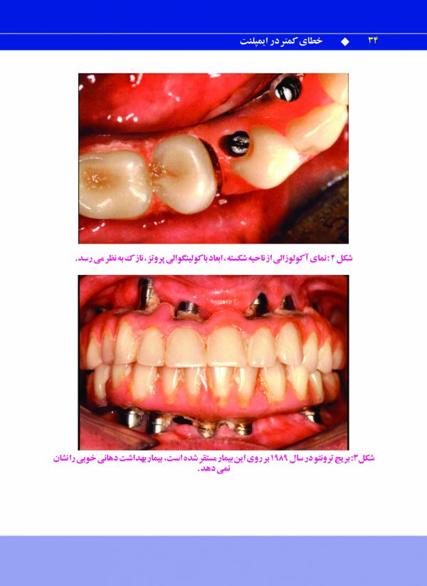 Pages-from-khataye-kamtar-0-Copy_Page_24-scaled