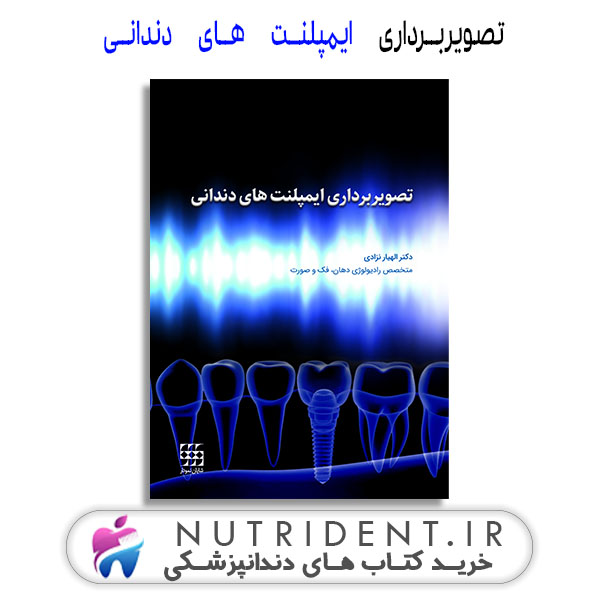 تصویربرداری ایمپلنت های دندانی | کتاب دندانپزشکی