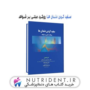 سفید کردن دندان ها رویکرد مبتنی بر شواهد کتاب دندانپزشکی