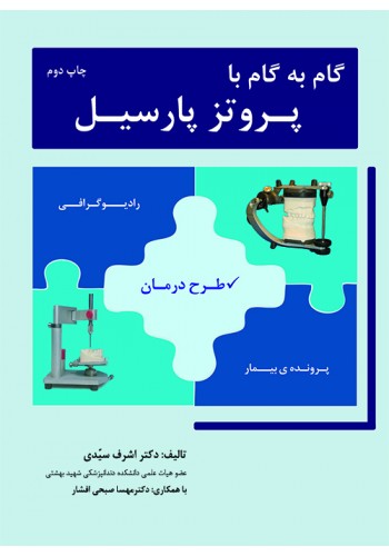 گام به گام با پروتز پارسیل چاپ سوم