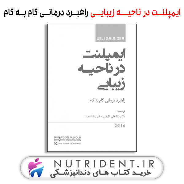 ایمپلنت در ناحیــه زیبایـی؛ راهبرد درمانی گام به گام | کتاب دندانپزشکی