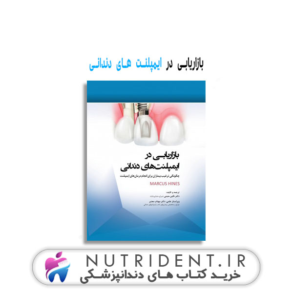 بازاریابی در ایمپلنت های دندانی چگونگی ترغیب بیماران برای انجام درمان های ایمپلنت کتاب دندانپزشکی بازاریابی در ایمپلنت های دندانی چگونگی ترغیب بیماران برای انجام درمان های ایمپلنت کتاب دندانپزشکی