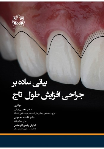 بیانی ساده بر جراحی افزایش طول تاج