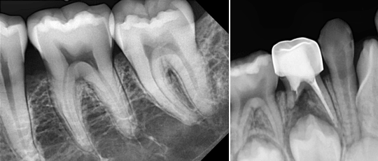 ظاهر سنسور آر وی جی Vatech ظاهر سنسور آر وی جی Vatech