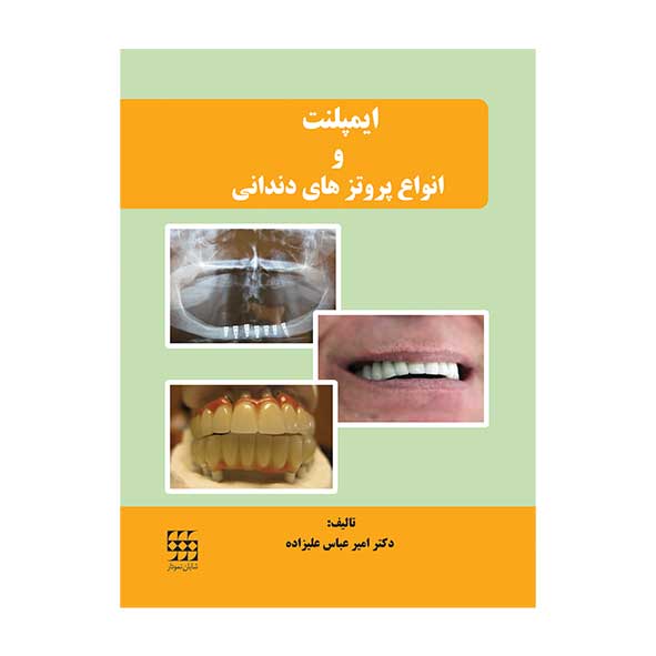 و-انواع-پروتزهای-دندانی
