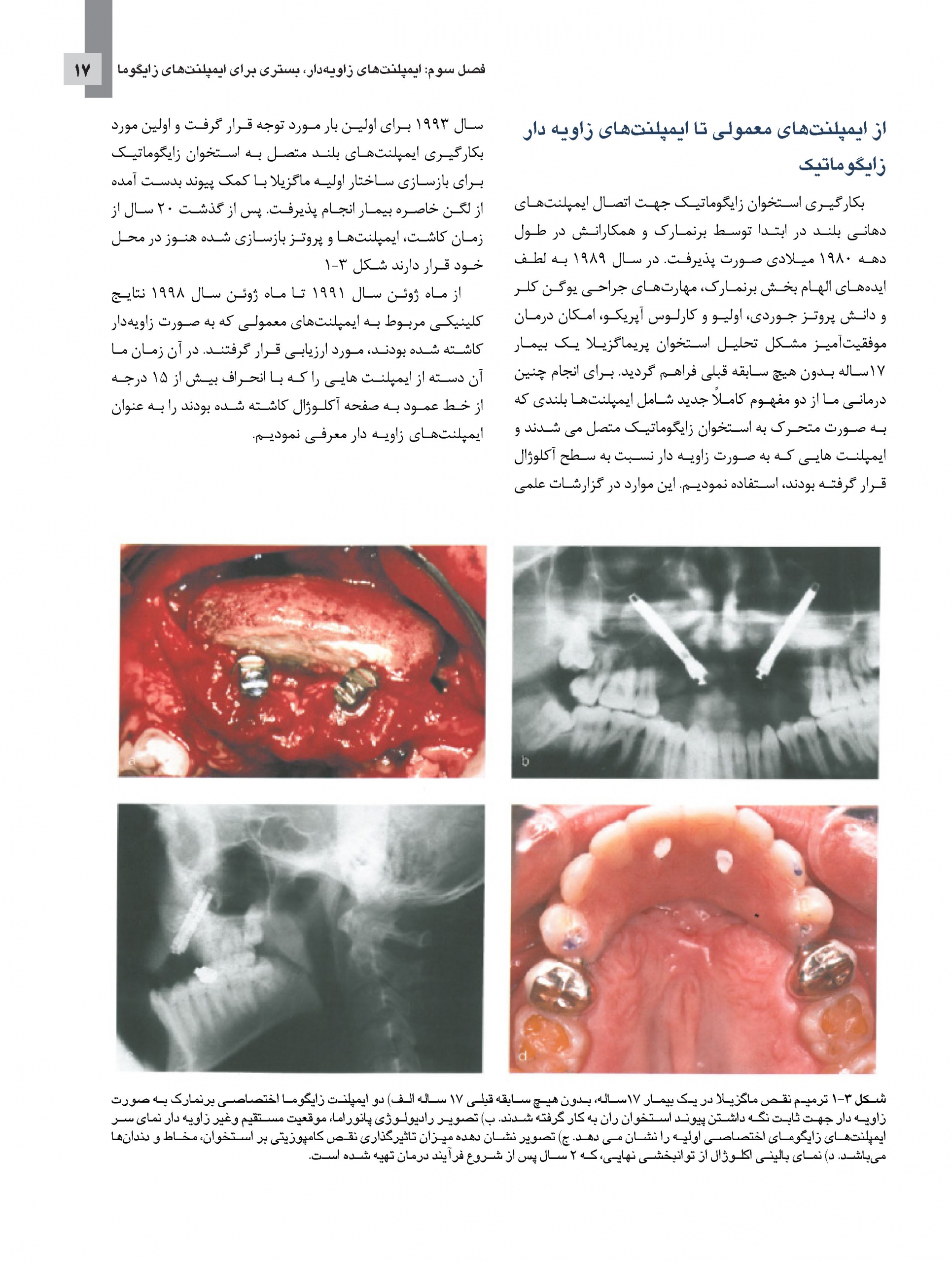 zygomatic-final_Page_13-scaled