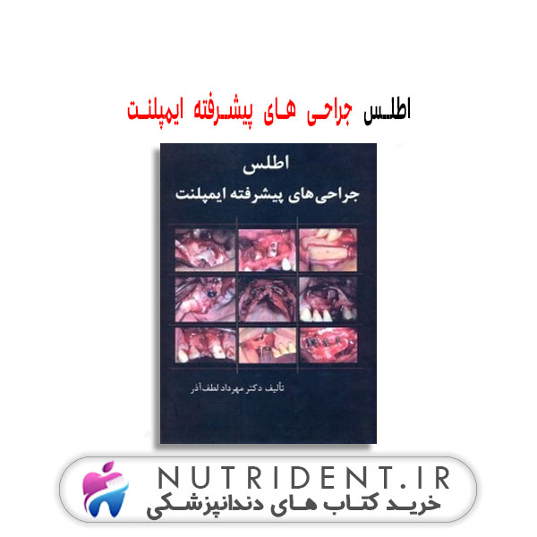 اطلس جراحی های پیشرفته ایمپلنت | کتاب دندانپزشکی