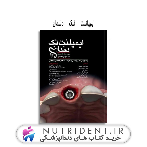 ایمپلنت تک دندان | کتاب دندانپزشکی