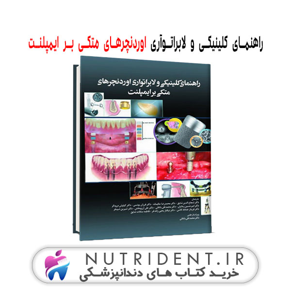 راهنمای کلینیکی و لابراتوآری اوردنچرهای متکی بر ایمپلنت کتاب دندانپزشکی راهنمای کلینیکی و لابراتوآری اوردنچرهای متکی بر ایمپلنت کتاب دندانپزشکی