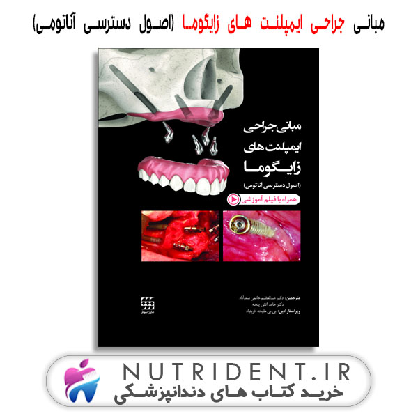 مبانی جراحی ایمپلنت های زایگوما (اصول دسترسی آناتومی) کتاب دندانپزشکی مبانی جراحی ایمپلنت های زایگوما (اصول دسترسی آناتومی) کتاب دندانپزشکی