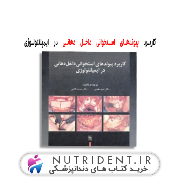 کاربرد پیوندهای استخوانی داخل دهانی در ایمپلنتولوژی | کتاب دندانپزشکی
