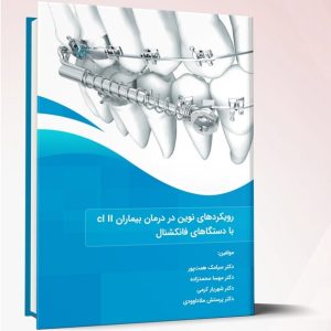 رویکردهای نوین در درمان بیماران cl II با دستگاه های فانکشنال