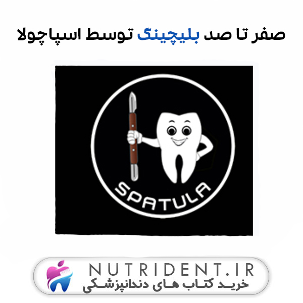 صفر تا صد بلیچینگ توسط اسپاچولا صفر تا صد بلیچینگ توسط اسپاچولا
