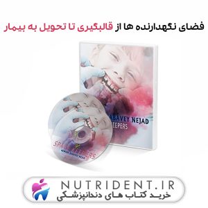 فضای نگهدارنده ها از قالبگیری تا تحویل به بیمار