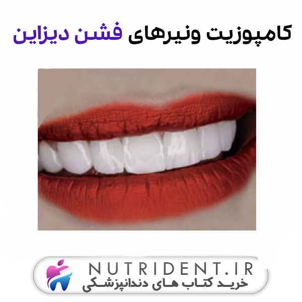 کامپوزیت ونیرهای فشن دیزاین کامپوزیت ونیرهای فشن دیزاین