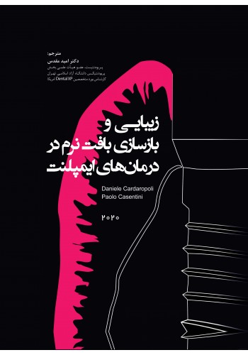 زیبایی و بازسازی بافت نرم در درمان های ایمپلنت