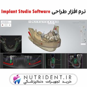 نرم افزار طراحی Implant Studio Software