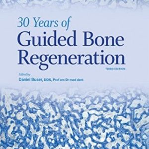 guided bone regeneration