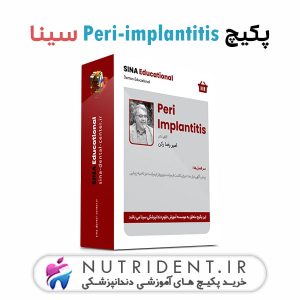 پکیچ Peri-implantitis سینا