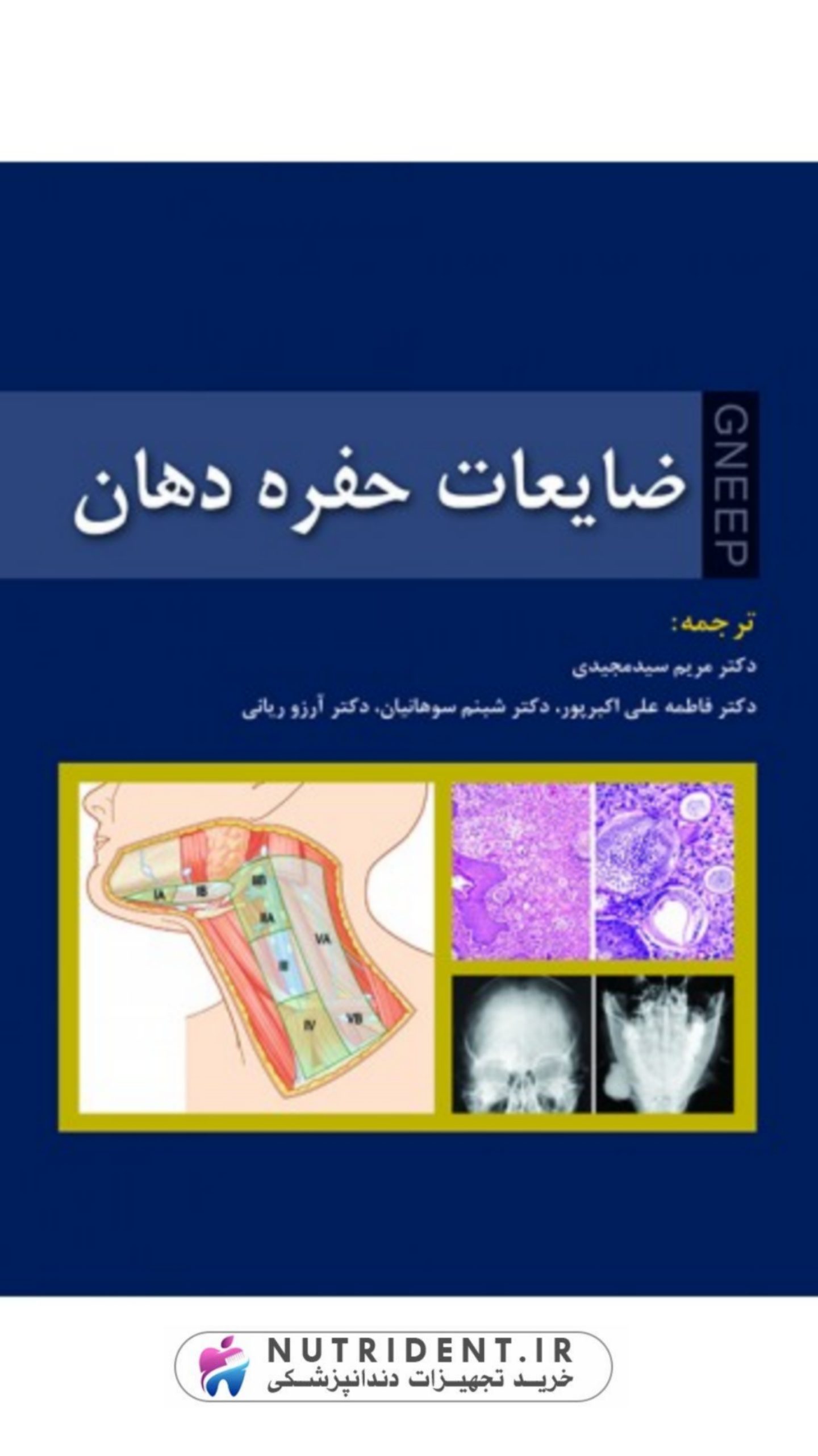 ضایعات حفره دهان ضایعات حفره دهان
