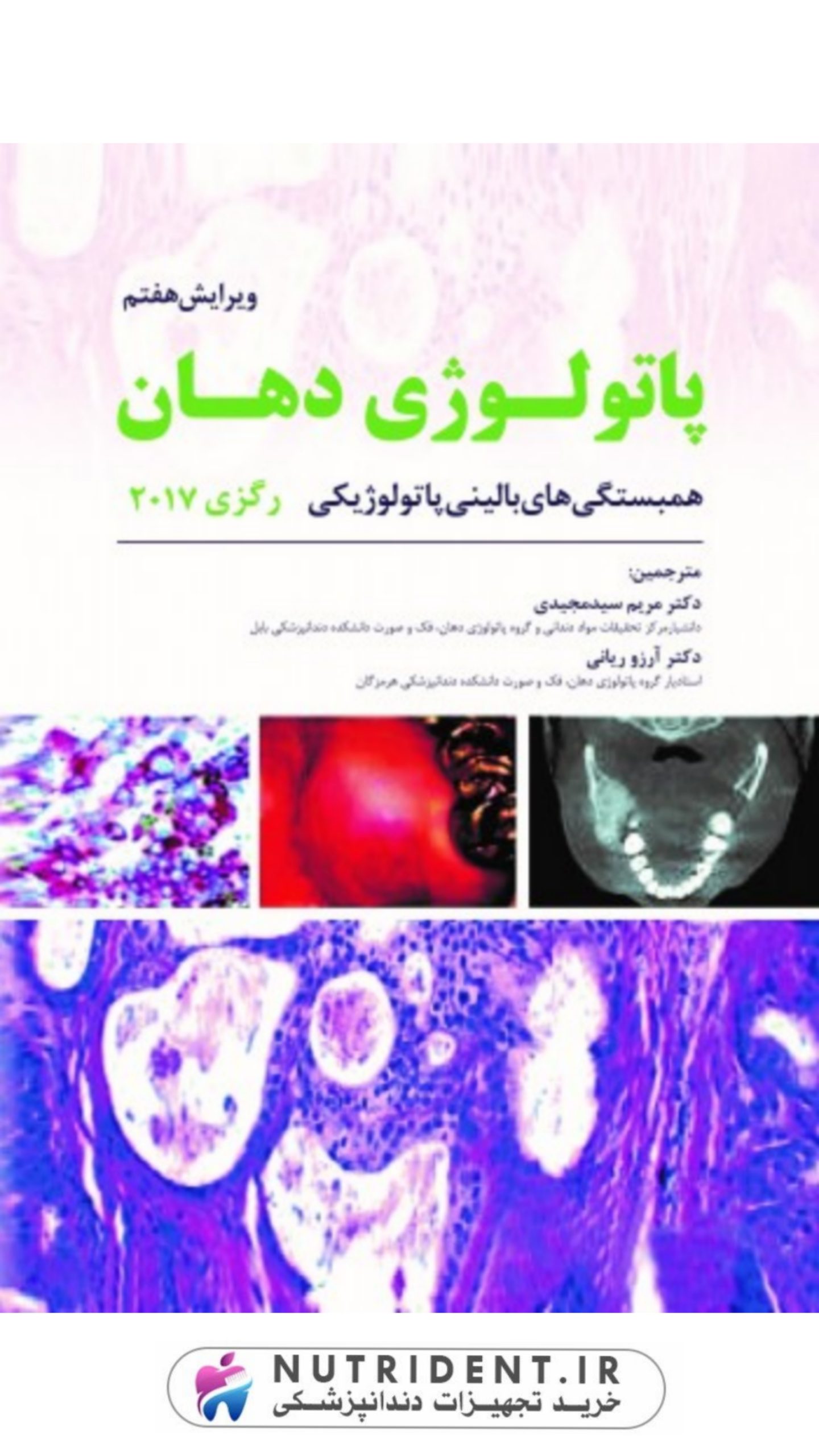 پاتولوژی دهان رگزی پاتولوژی دهان رگزی