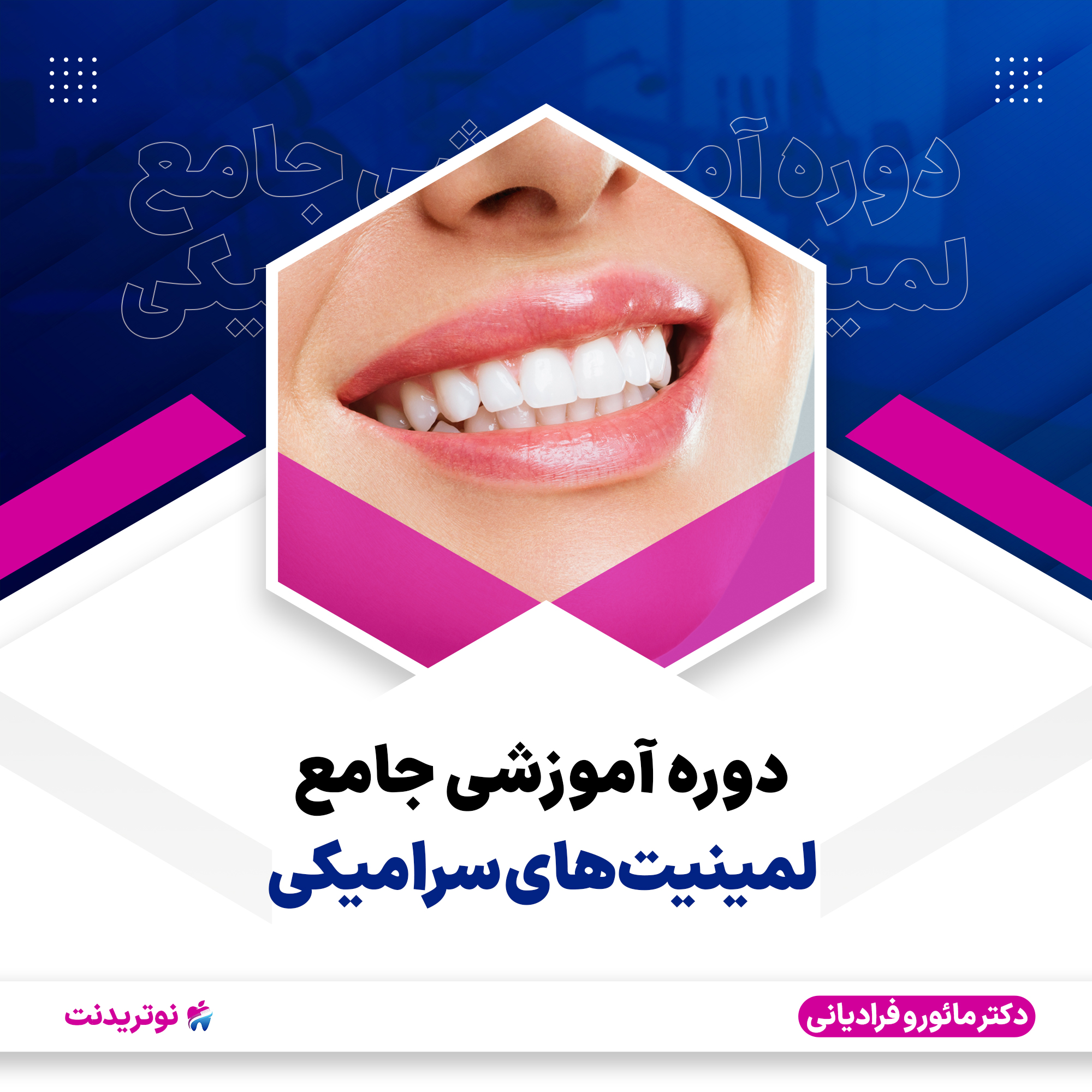 دوره آموزشی لمینیت های سرامیکی
