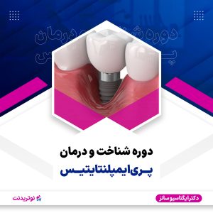 دوره آموزشی شناخت و درمان پری ایمپلنتایتیس
