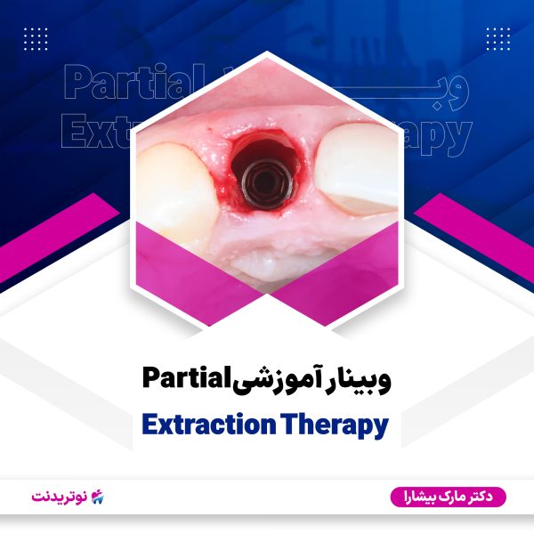 کاور وبینار Partial Extraction Therapy وبینار Partial Extraction Therapy