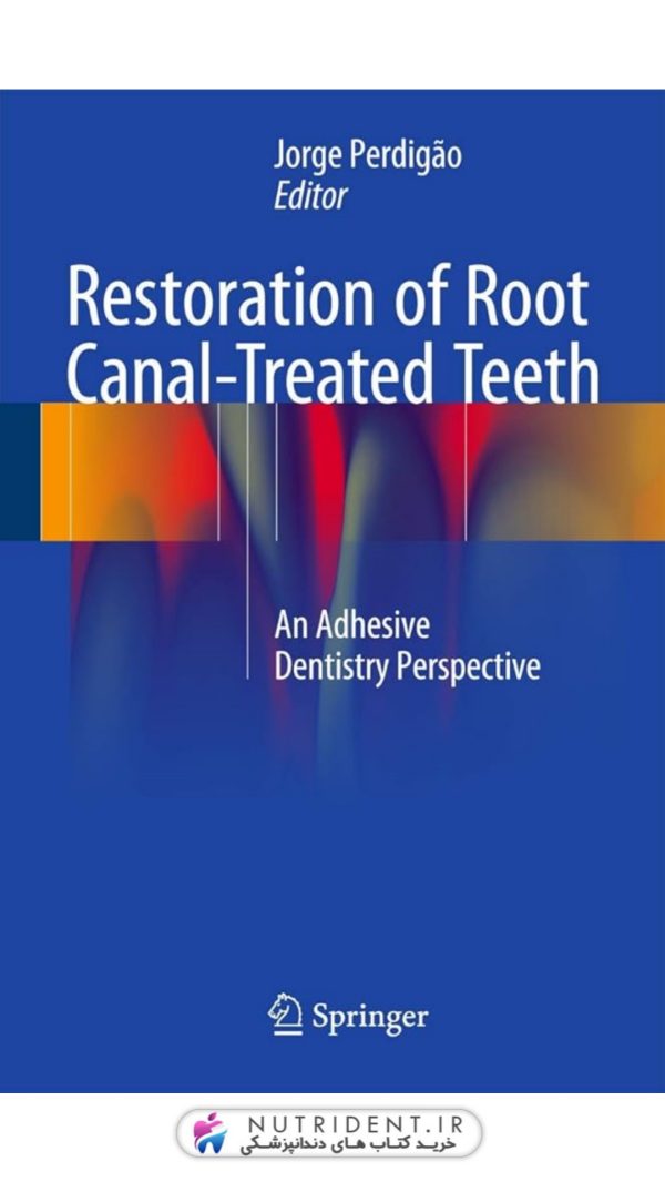 restoration for root canal treated