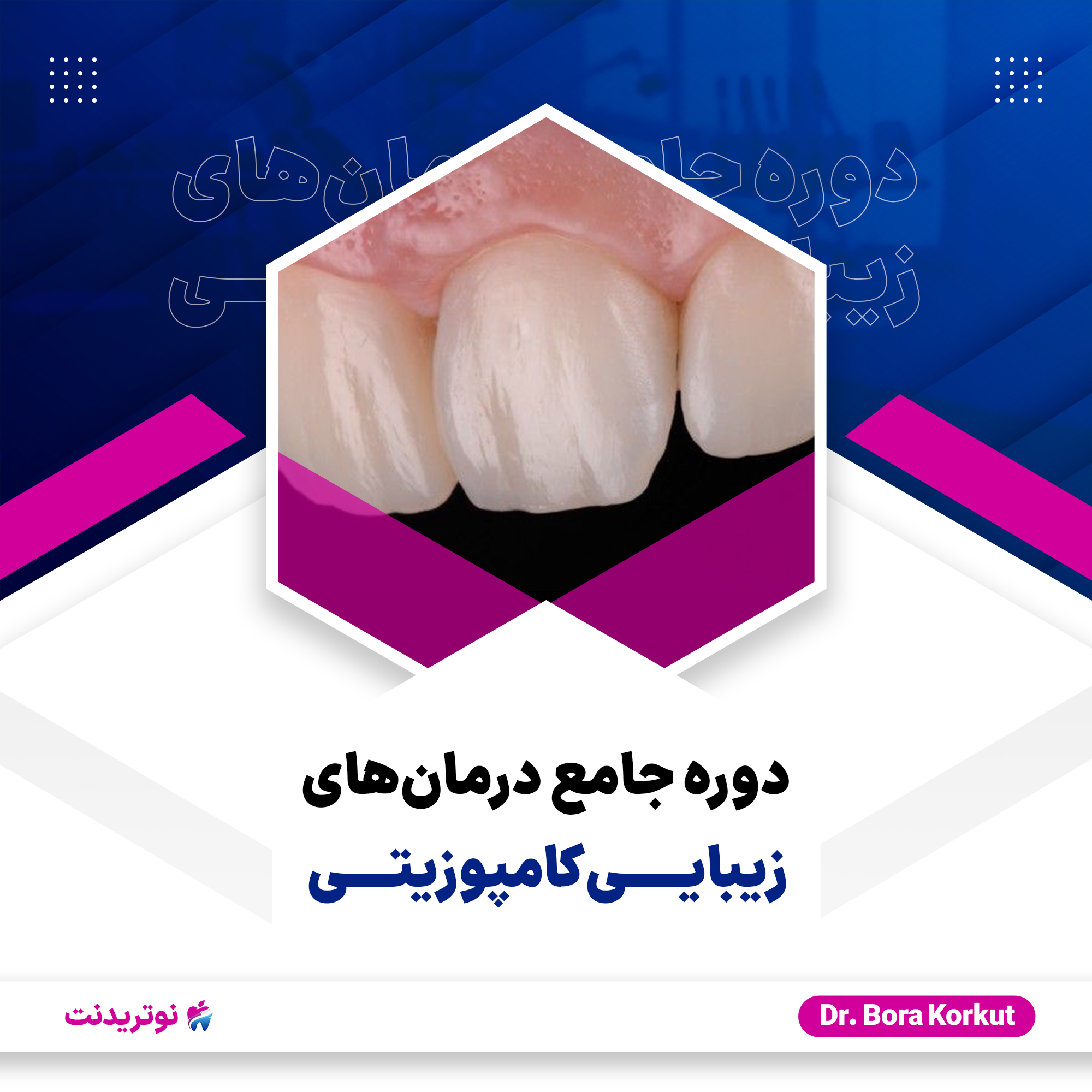 دوره آموزشی جامع درمان های زیبایی کامپوزیتی
