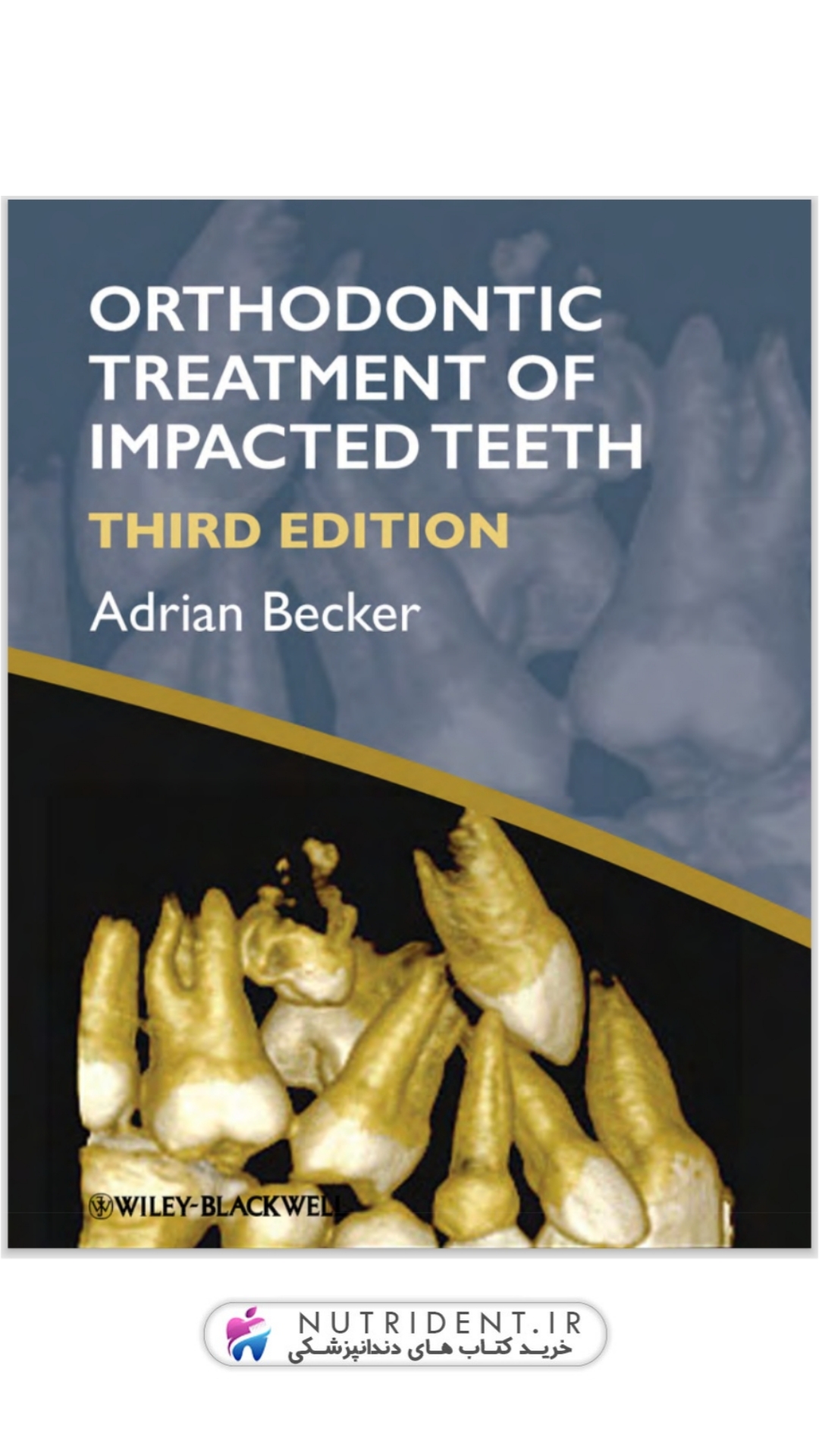 Orthodontic Treatment of Impacted Teeth, 4th Edition