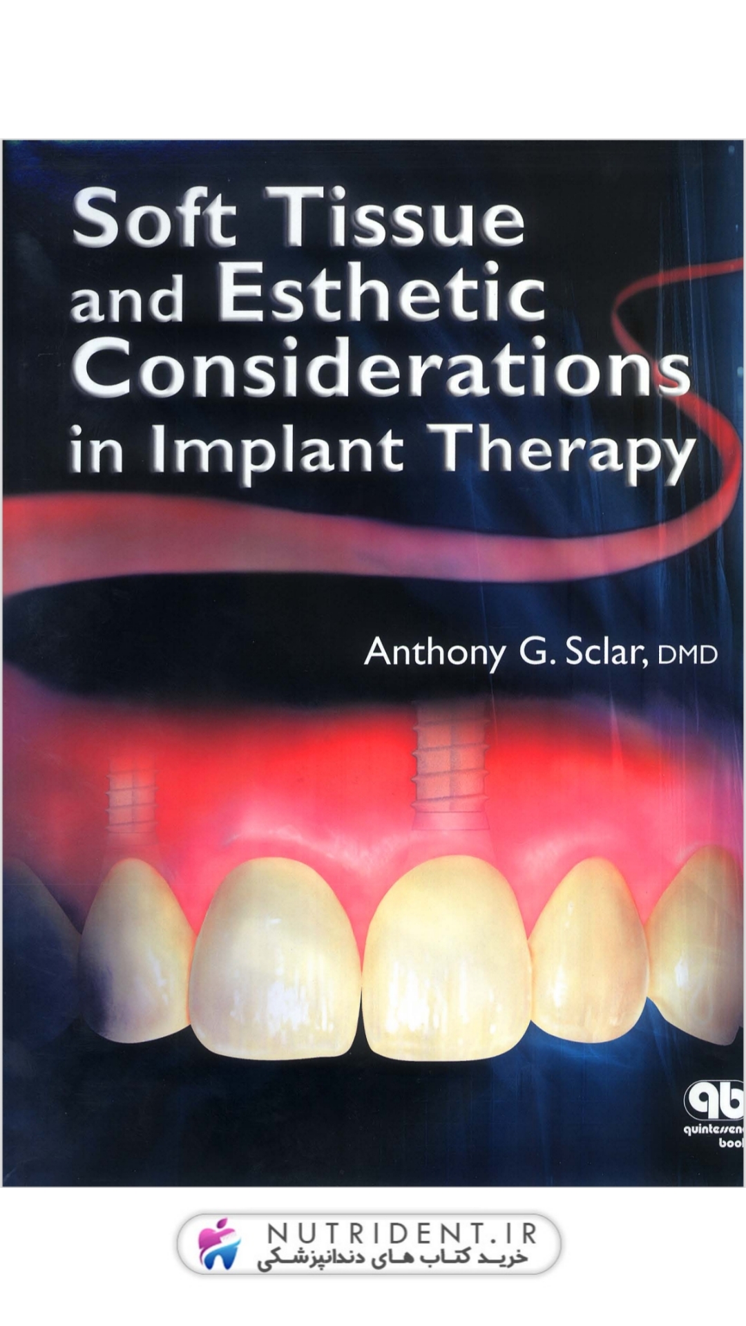 Soft Tissue and Esthetic Considerations in Implant Dentistry 1st Edition