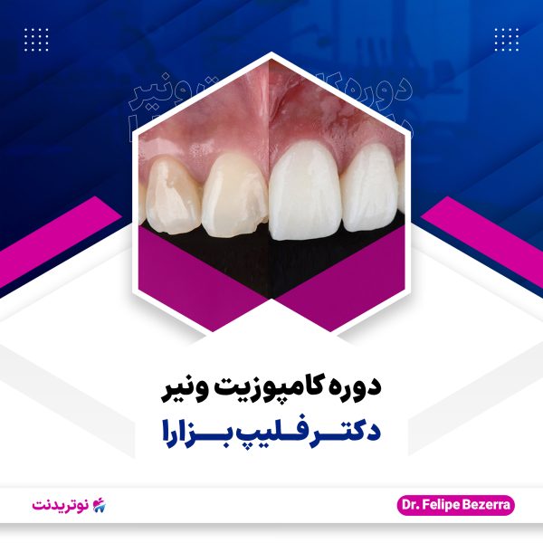 کاور دوره کامپوزیت ونیر دکتر فلیپ بزارا دوره کامپوزیت ونیر دکتر فلیپ بزارا
