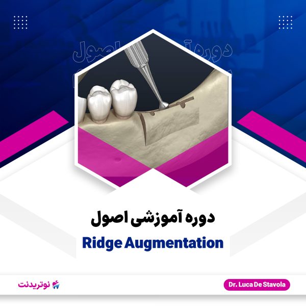 کاور دوره آموزشی اصول ridge augmentation دوره آموزشی اصول ridge augmentation