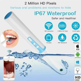 دوربین داخل دهانی دندانپزشکی Dental C