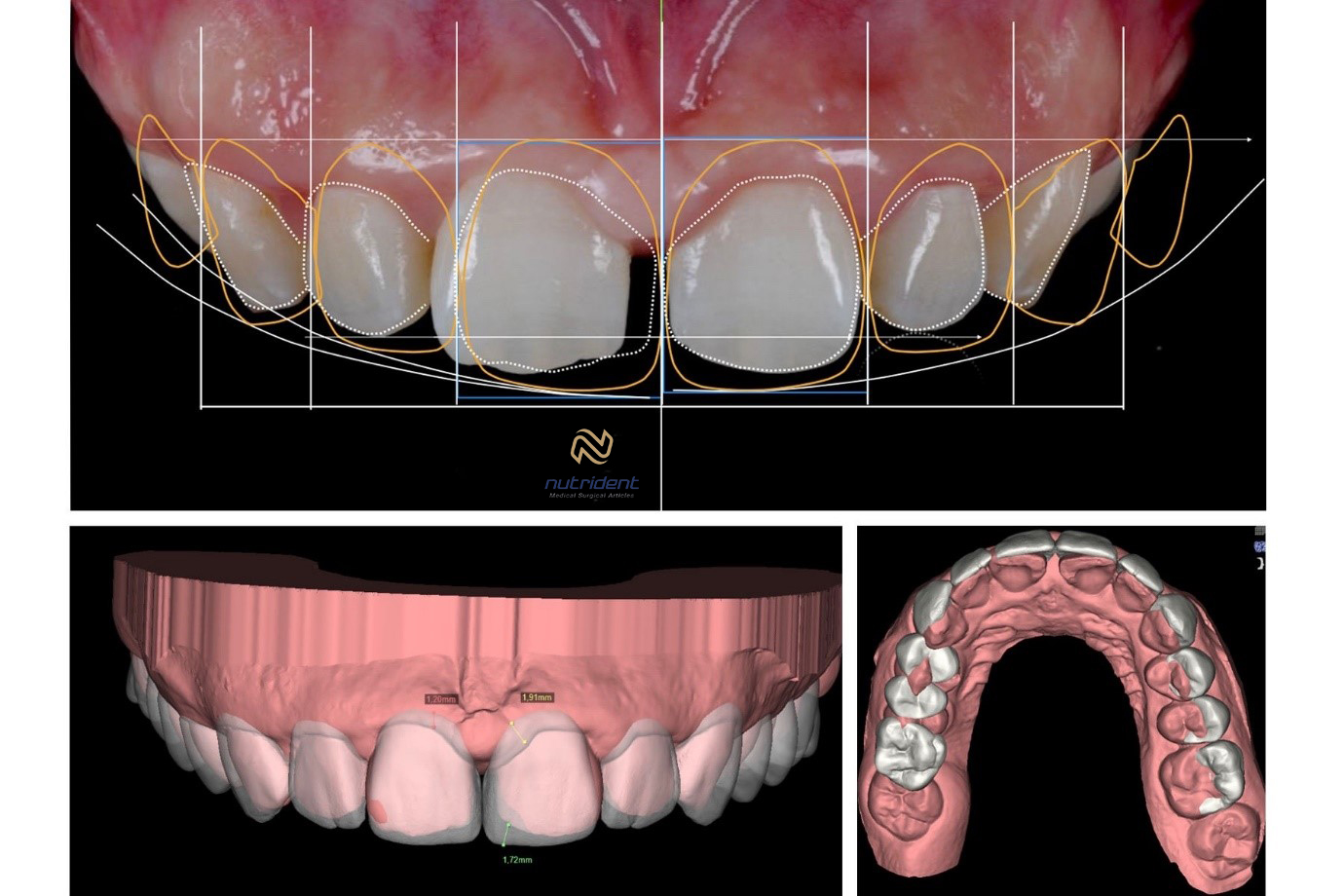 تجهیزات طراحی لبخند دیجیتال - نوتریدنت