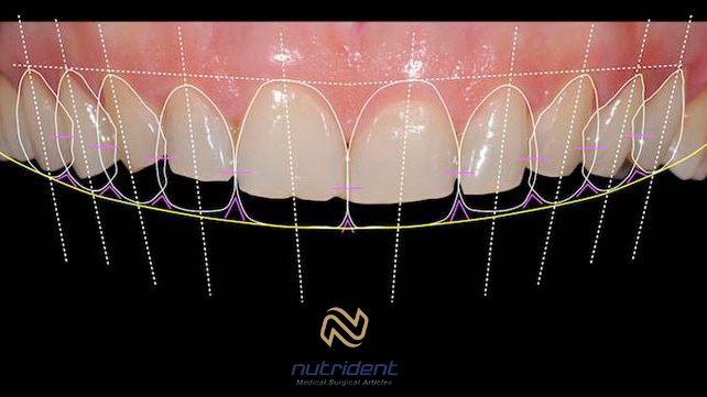 طراحی لبخند دیجیتال - نوتریدنت