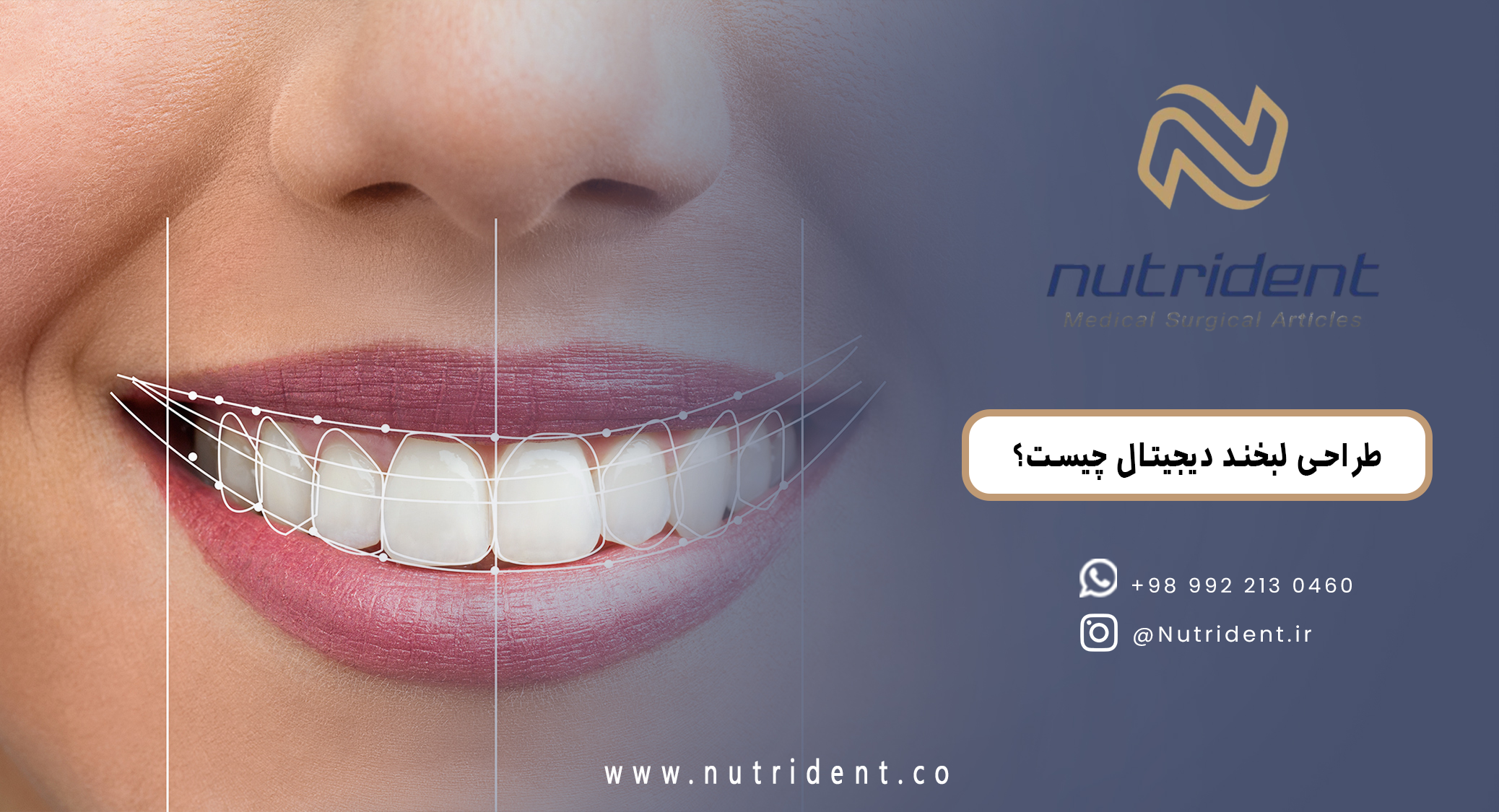 طراحی لبخند دیجیتال چیست؟ مراحل، نرم‌افزارها و مزایای آن در دندانپزشکی